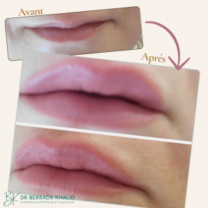 Accueil 5 Dr Berrada Khalid - Chirurgien esthétique et plastique à Fès 1 Accueil