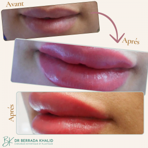 Accueil 25 Dr Berrada Khalid - Chirurgien esthétique et plastique à Fès 10 Accueil