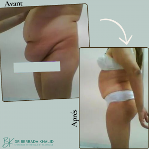 Accueil 17 Dr Berrada Khalid - Chirurgien esthétique et plastique à Fès 14 Accueil