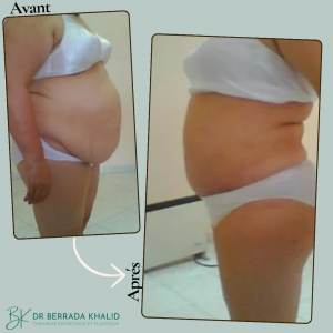 Accueil 16 Dr Berrada Khalid - Chirurgien esthétique et plastique à Fès 16 Accueil