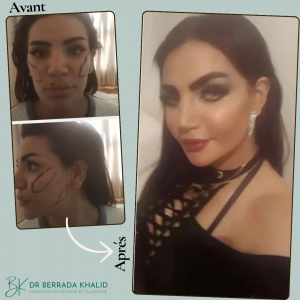Accueil 8 Dr Berrada Khalid - Chirurgien esthétique et plastique à Fès 17 Accueil