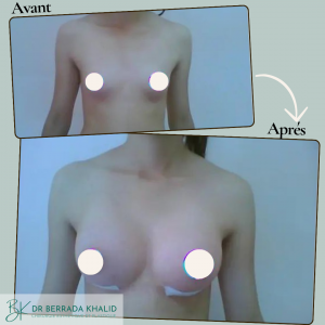 Accueil 15 Dr Berrada Khalid - Chirurgien esthétique et plastique à Fès 18 Accueil