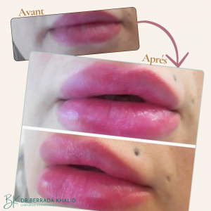 Accueil 10 Dr Berrada Khalid - Chirurgien esthétique et plastique à Fès 2 Accueil