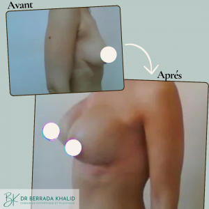 Accueil 9 Dr Berrada Khalid - Chirurgien esthétique et plastique à Fès 21 Accueil