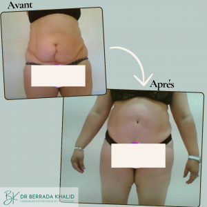 Accueil 2 Dr Berrada Khalid - Chirurgien esthétique et plastique à Fès 23 Accueil