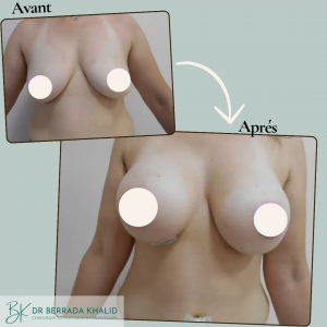 Accueil 4 Dr Berrada Khalid - Chirurgien esthétique et plastique à Fès 24 Accueil