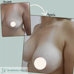 Accueil 1 Dr Berrada Khalid - Chirurgien esthétique et plastique à Fès 25 Accueil