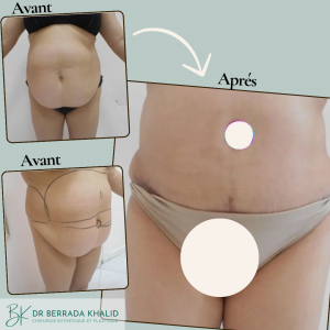 Accueil 6 Dr Berrada Khalid - Chirurgien esthétique et plastique à Fès 27 Accueil