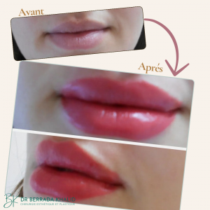 Accueil 20 Dr Berrada Khalid - Chirurgien esthétique et plastique à Fès 3 Accueil