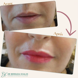 Accueil 19 Dr Berrada Khalid - Chirurgien esthétique et plastique à Fès 4 Accueil