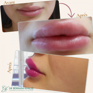 Accueil 18 Dr Berrada Khalid - Chirurgien esthétique et plastique à Fès 5 Accueil