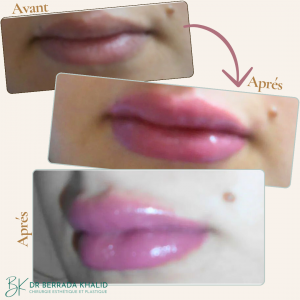 Accueil 13 Dr Berrada Khalid - Chirurgien esthétique et plastique à Fès 6 Accueil