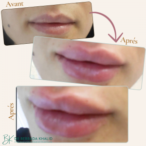 Accueil 11 Dr Berrada Khalid - Chirurgien esthétique et plastique à Fès 7 Accueil