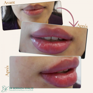 Accueil 7 Dr Berrada Khalid - Chirurgien esthétique et plastique à Fès 8 Accueil