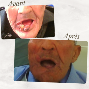 Dr Berrada Khalid - Chirurgien esthétique et plastique à Fès unnamed file 3 Interventions